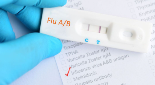 İnfluenza hızlı teşhis test arka planı ve tedavi